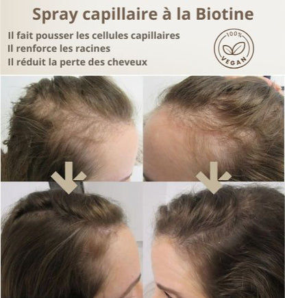 Spray capillaire à la BIOTINE